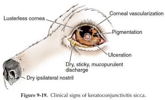 Keratoconjunctivitis Sicca : 네이버 블로그