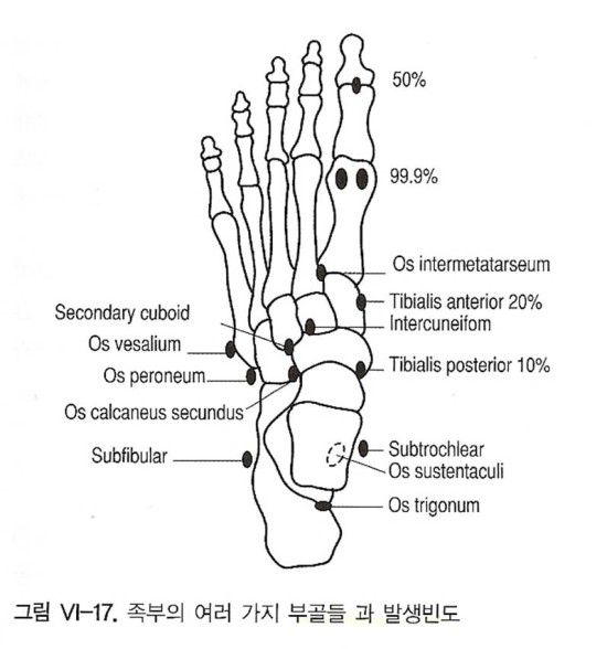 accessory bones of foot (족부의 부골) accessory navicular (부주상골) 외 네이버 블로그