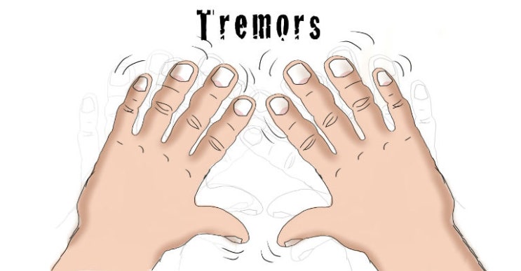 essential Tremor essential-tremor