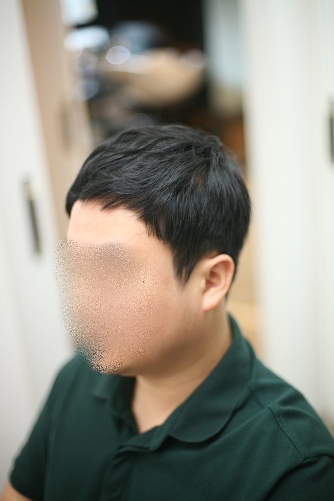이마 넓은 남자 M자 머리 탈모헤어스타일 : 네이버 블로그