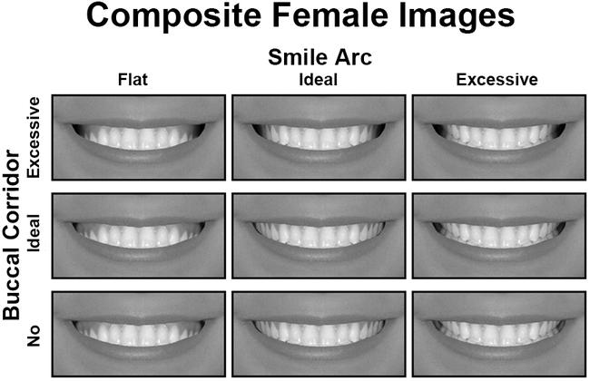 Attractiveness of the Smile Arc & Buccal Corridor Space : 네이버 블로그