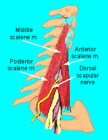 Dorsal scapular nerve entrapment : 네이버 블로그